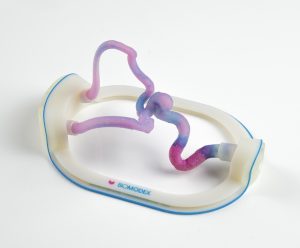 CES 2018: Watch How 3D Printing Can Transform Patient Care