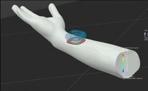 Optimizing medical devices in the virtual world