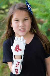 8-Year-Old with 3D-Printed Hand Throws Opening Pitch for Red Sox on #Journeyto30
