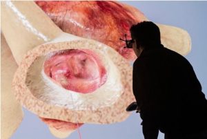 The promise of virtual patients