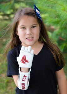 8-Year-Old with 3D-Printed Hand to Throw Opening Pitch for Red Sox on #Journeyto30