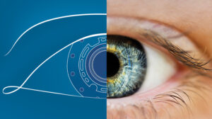 Seeing the potential for a future without blindness