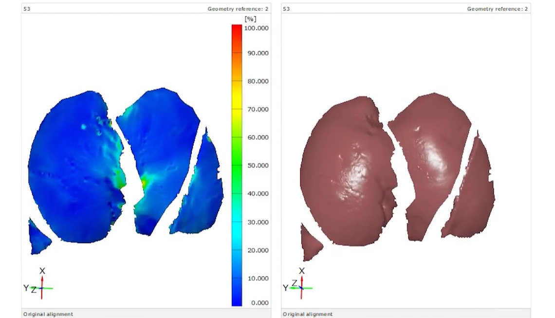 Breathing New Life into Lung Research with Simulation - Dassault ...